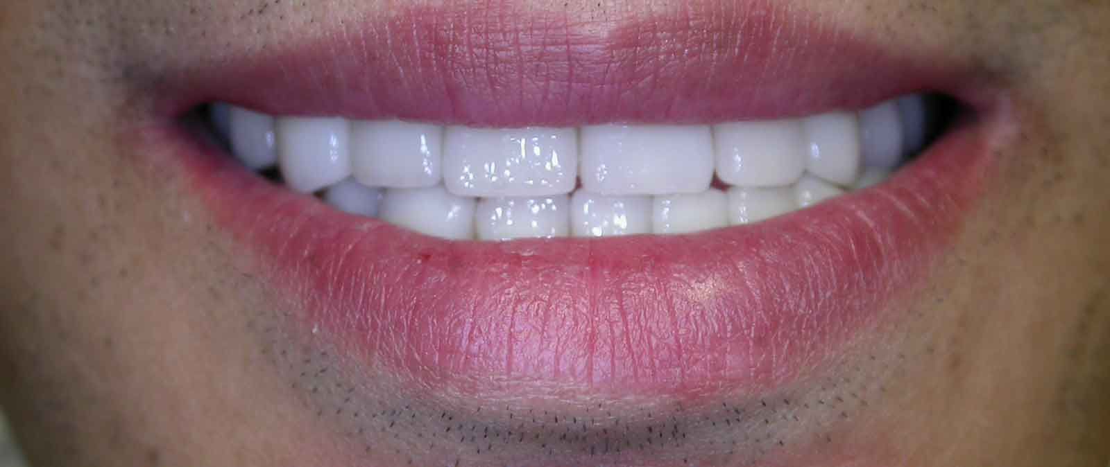 After