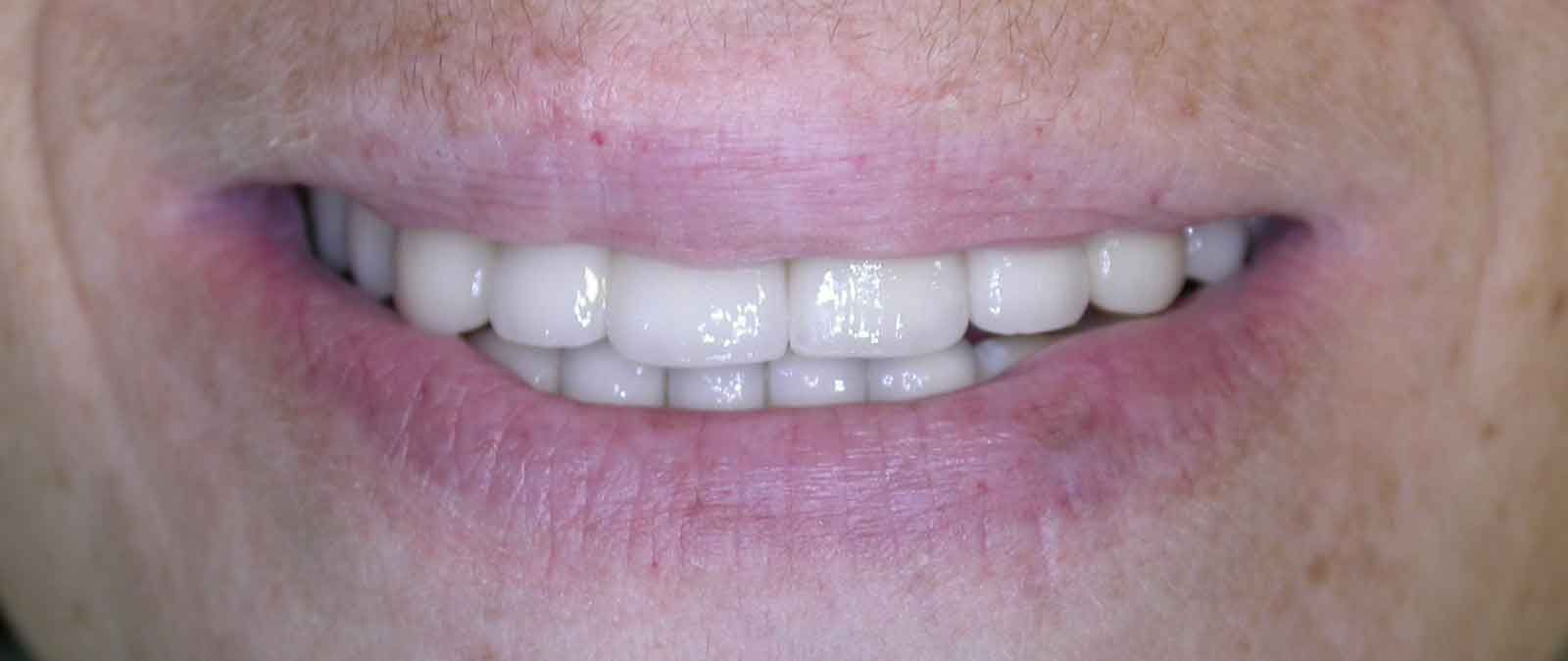 After