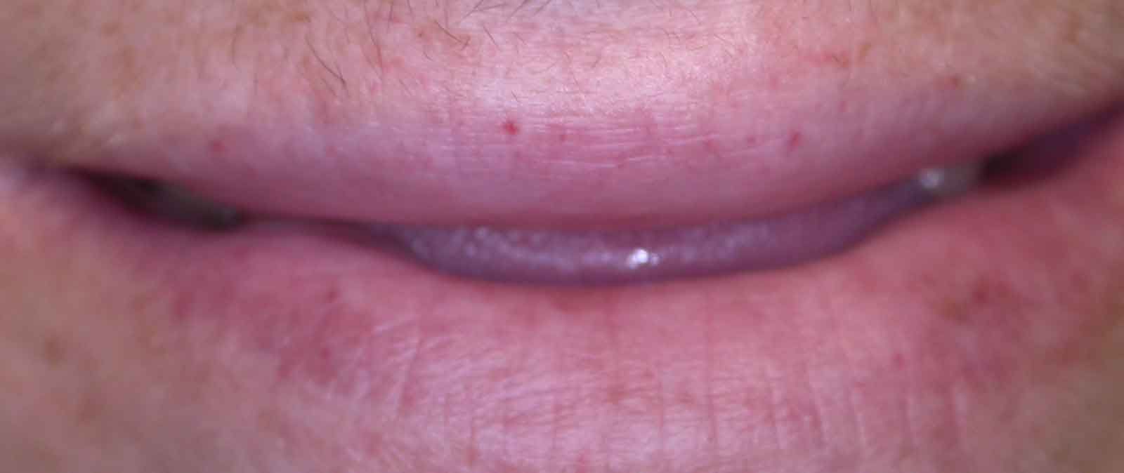 Before